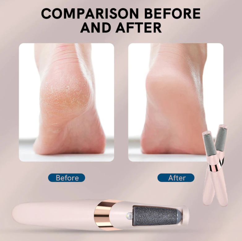 Electric foot grinder, Callus remover tool, Foot file grinder, Pedicure foot grinder, Professional foot grinder, Rechargeable foot grinder, Electric callus remover, Foot exfoliating grinder, Battery-powered foot grinder, Foot care grinder, Pumice stone foot grinder, Cordless foot grinder, Foot scrubber grinder, Electric heel grinder, Foot callus grinder.